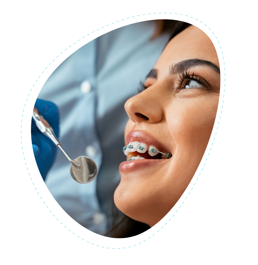 Dental Braces Service in Flower Mound TX