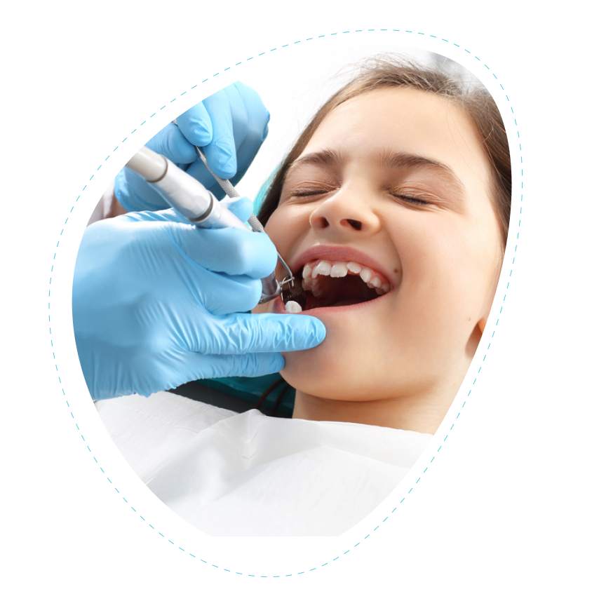 Dental Sealants treatment Flower Mound, TX