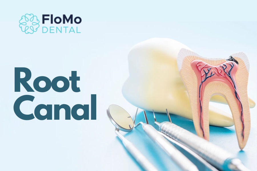 root canal treatments